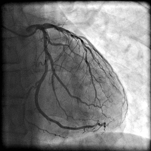 Angiography Images